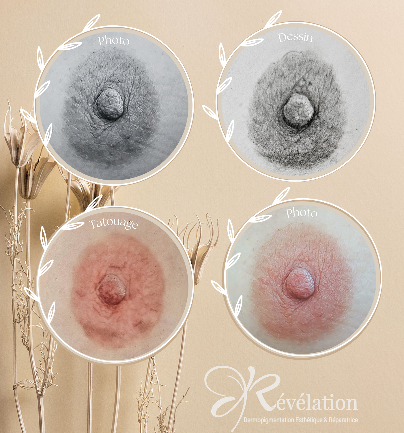 Dessin et tatouage aréole - dermopigmentation Révélation - Albi