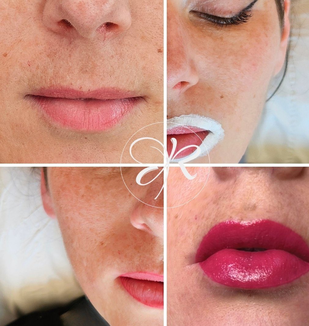 Etapes pigmentation des lèvres