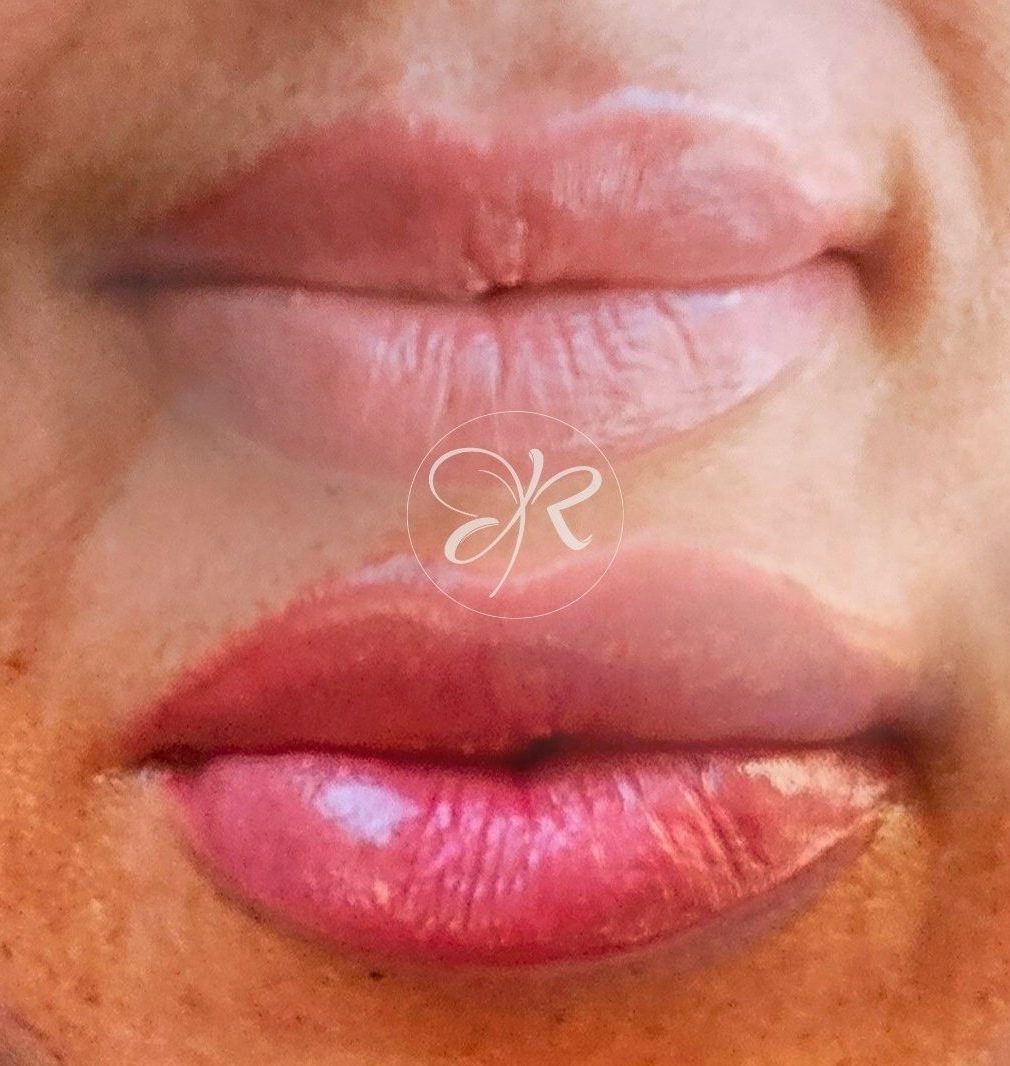 pigmentation des lèvres maquillage permanent albi