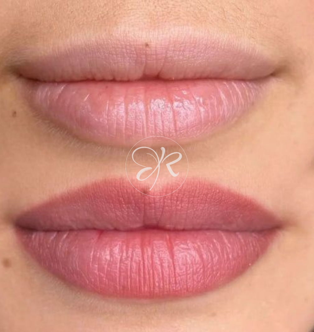 pigmentation lèvres aquarelle avant après