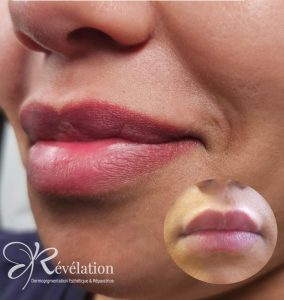 résultat maquillage permanent des lèvres avant/après NATUREL- institut révélation albi