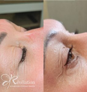 avant après maquillage permanent liner